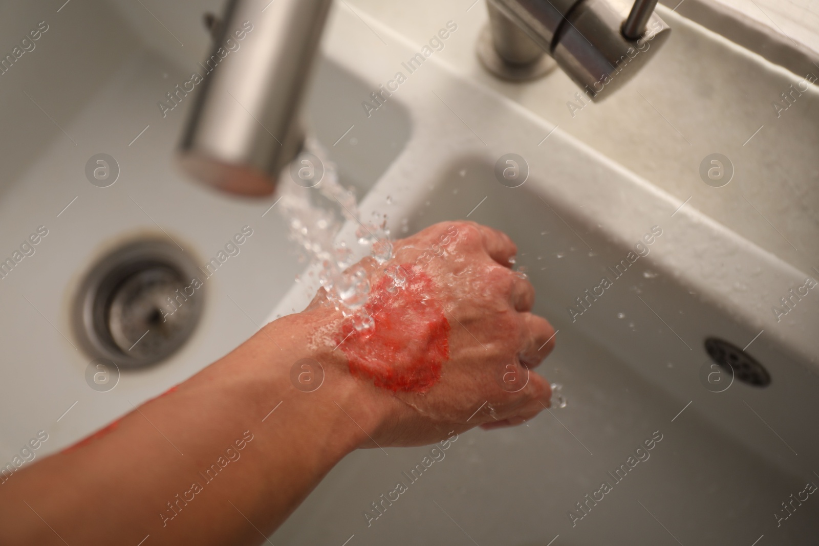 Photo of Man holding burned hand under water indoors, above view