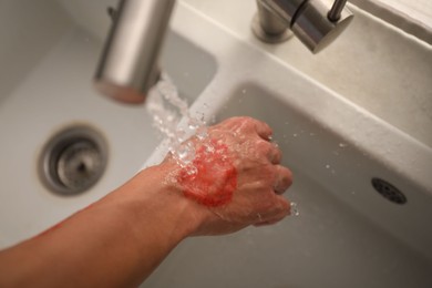 Photo of Man holding burned hand under water indoors, above view
