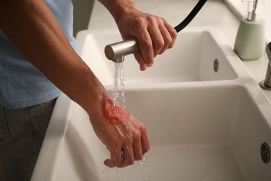Photo of Man holding burned hand under water indoors, closeup