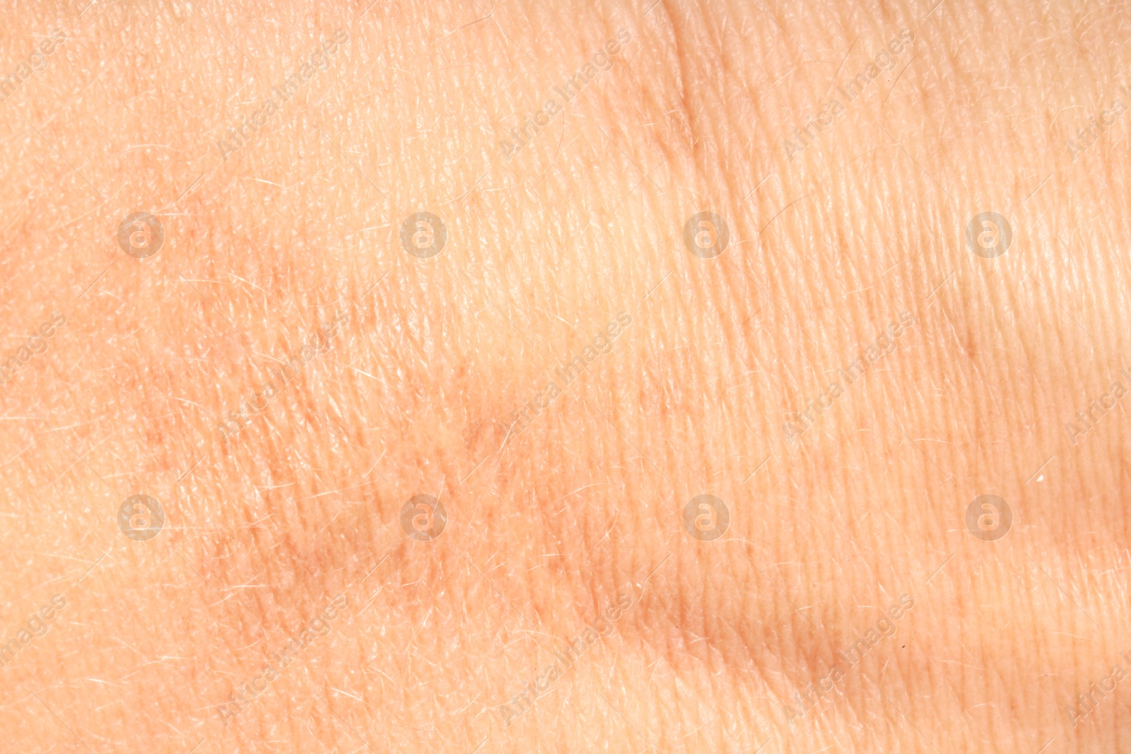 Human skin, closeup view. Detailed texture of surface Photo of Human skin, closeup view. Detailed texture of surface