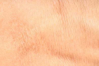Photo of Human skin, closeup view. Detailed texture of surface
