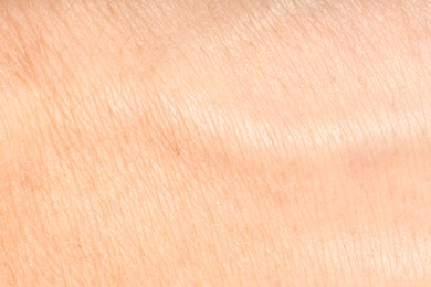 Photo of Human skin, closeup view. Detailed texture of surface