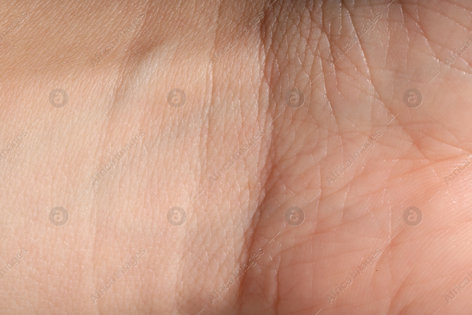 Human skin, closeup view. Detailed texture of surface Photo of Human skin, closeup view. Detailed texture of surface