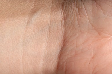 Photo of Human skin, closeup view. Detailed texture of surface