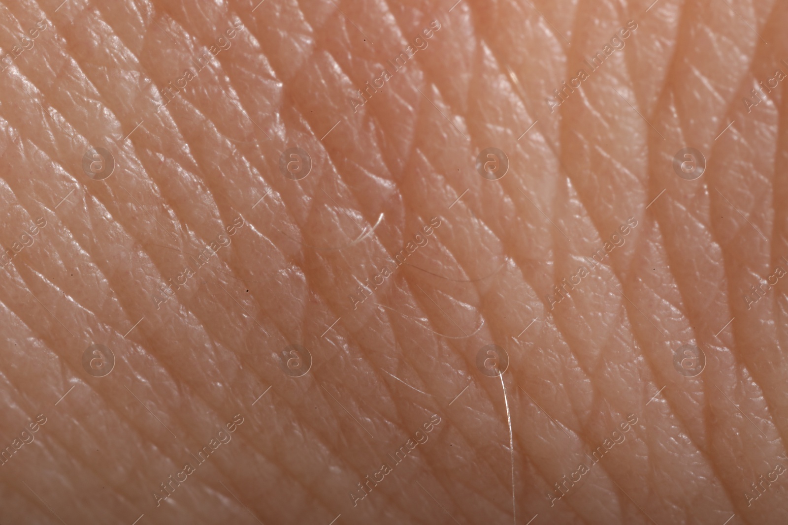 Human skin, closeup view. Detailed texture of surface Photo of Human skin, closeup view. Detailed texture of surface