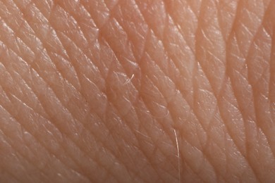 Photo of Human skin, closeup view. Detailed texture of surface
