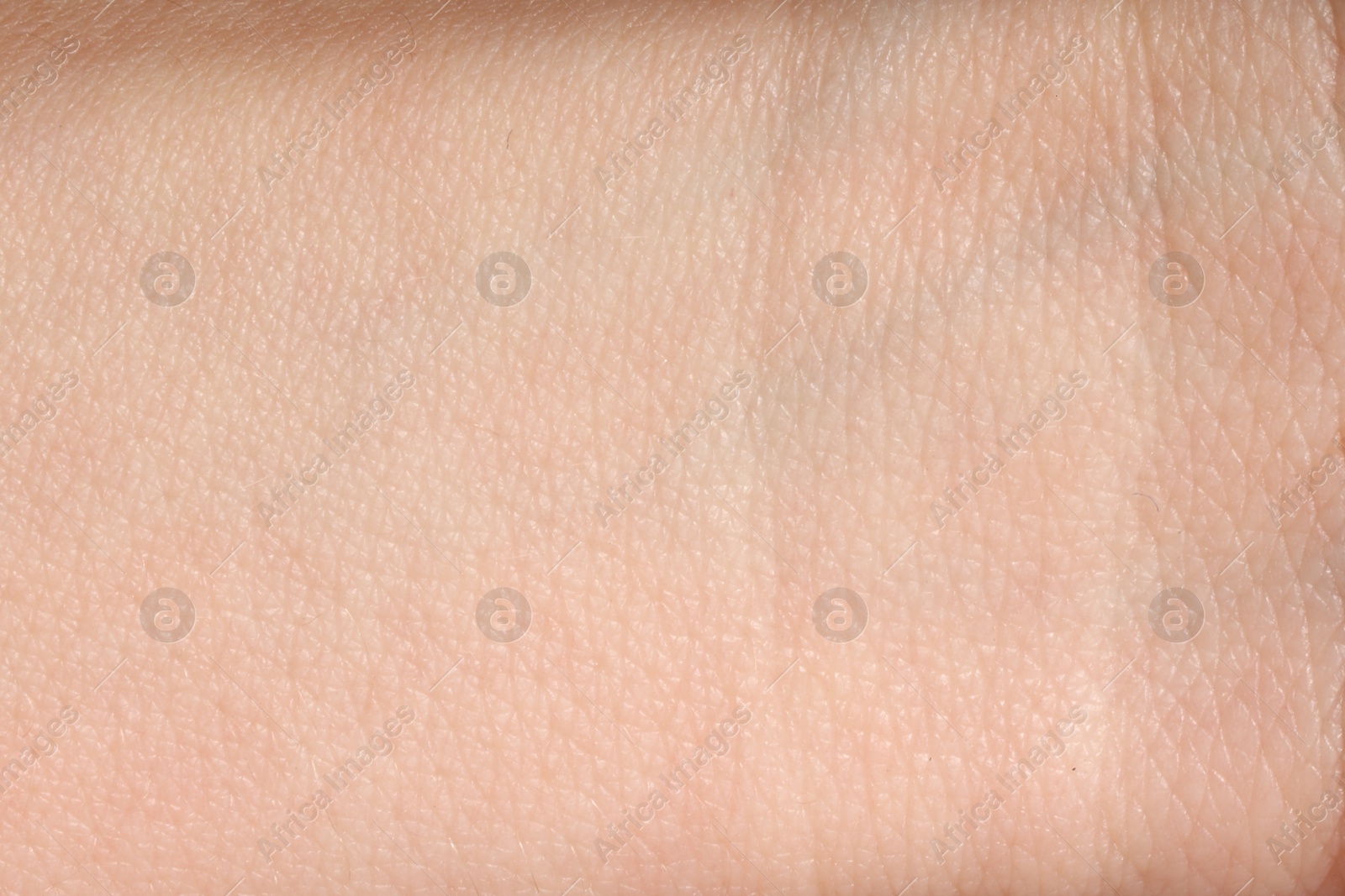 Human skin, closeup view. Detailed texture of surface Photo of Human skin, closeup view. Detailed texture of surface