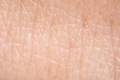 Photo of Human skin, closeup view. Detailed texture of surface