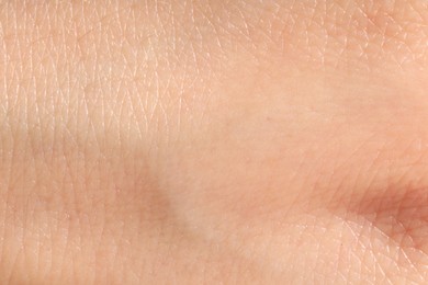 Photo of Human skin, closeup view. Detailed texture of surface