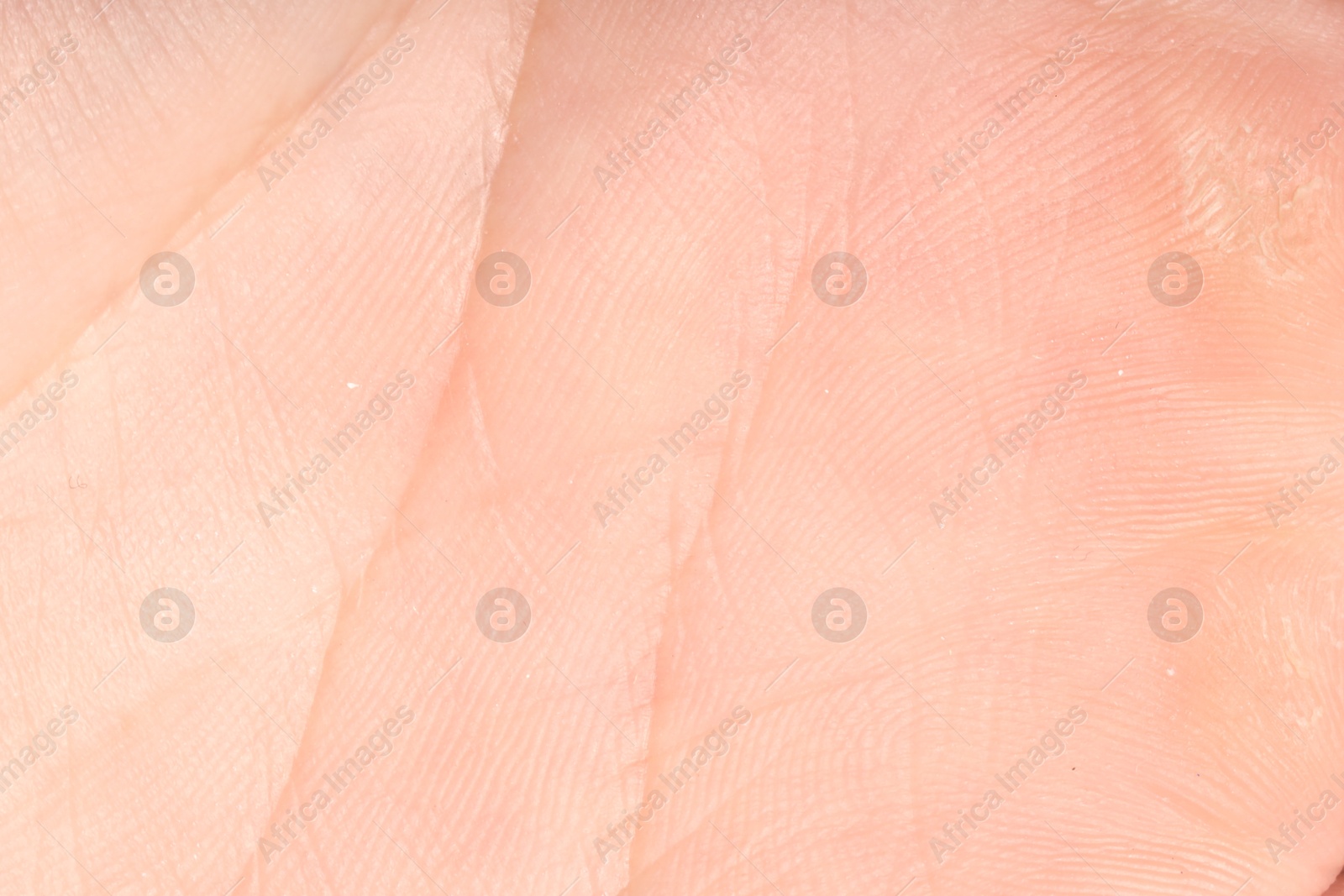 Human skin, closeup view. Detailed texture of surface Photo of Human skin, closeup view. Detailed texture of surface