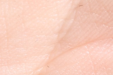 Photo of Human skin, closeup view. Detailed texture of surface