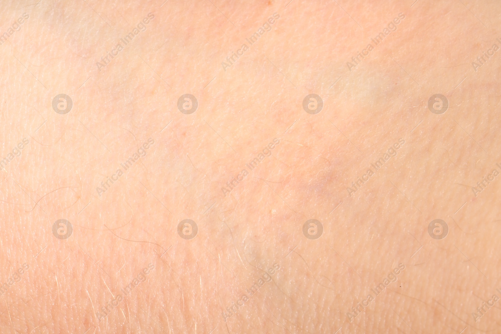 Human skin, closeup view. Detailed texture of surface Photo of Human skin, closeup view. Detailed texture of surface