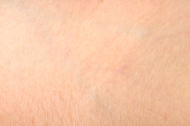 Photo of Human skin, closeup view. Detailed texture of surface