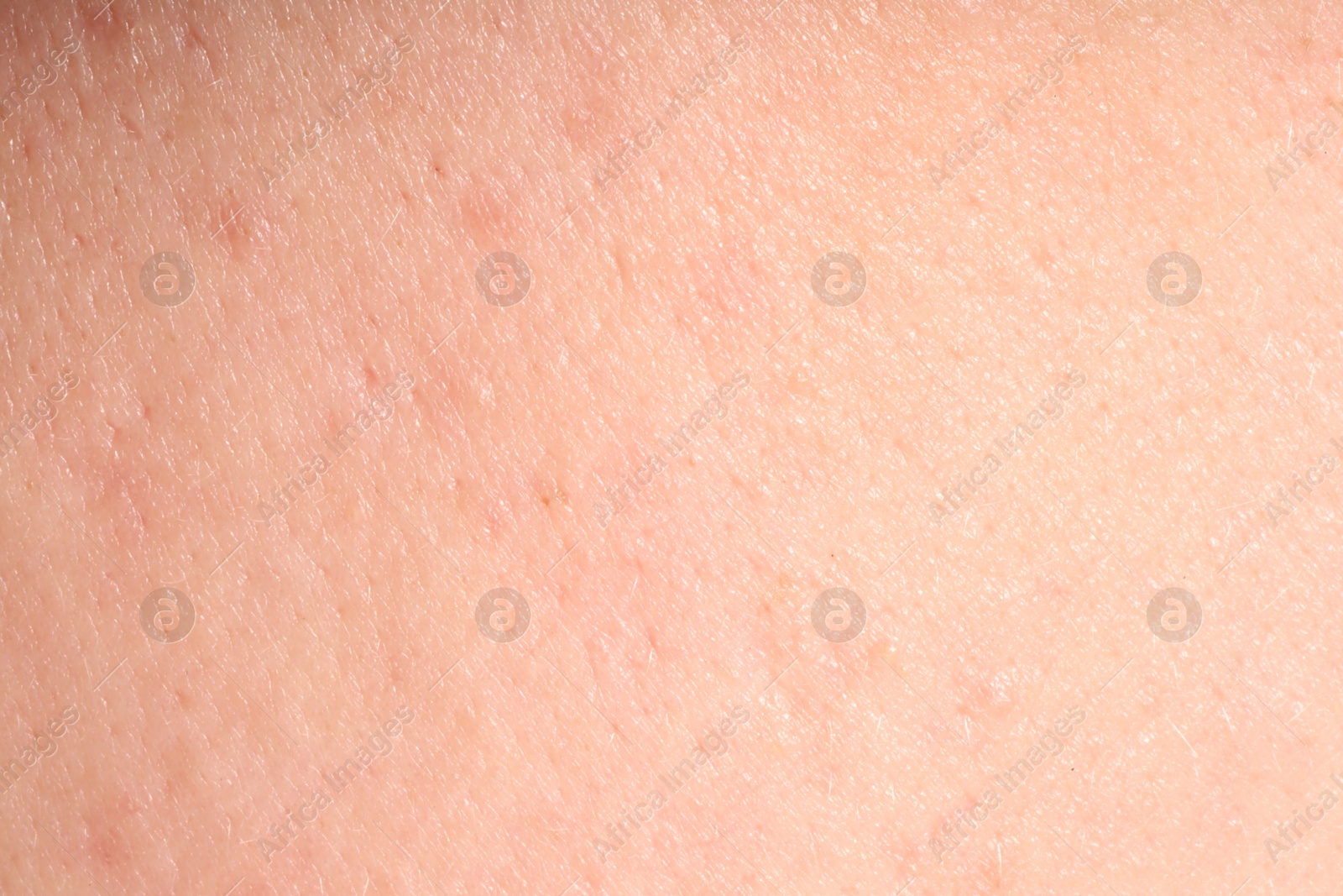 Human skin, closeup view. Detailed texture of surface Photo of Human skin, closeup view. Detailed texture of surface