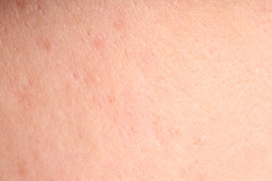 Photo of Human skin, closeup view. Detailed texture of surface