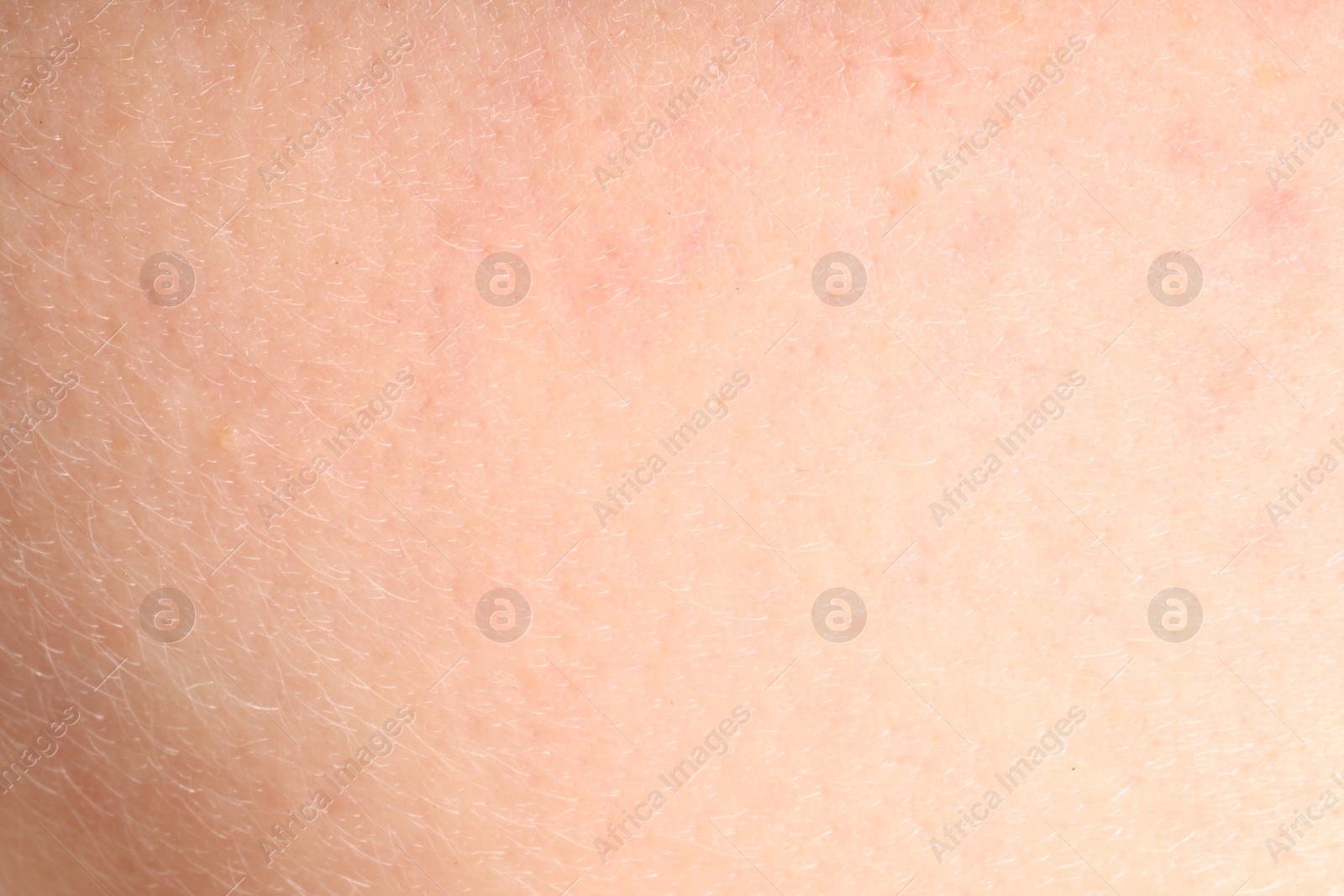 Human skin, closeup view. Detailed texture of surface Photo of Human skin, closeup view. Detailed texture of surface