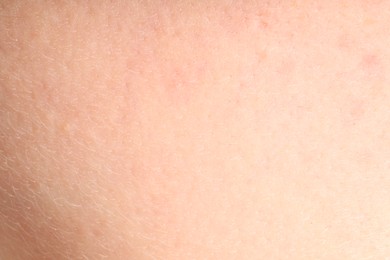 Photo of Human skin, closeup view. Detailed texture of surface