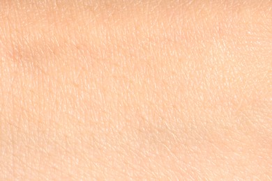 Photo of Human skin, closeup view. Detailed texture of surface