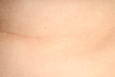 Photo of Human skin, closeup view. Detailed texture of surface
