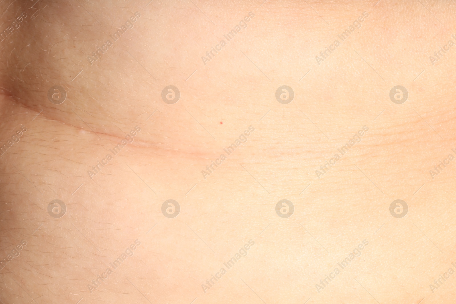 Photo of Human skin, closeup view. Detailed texture of surface