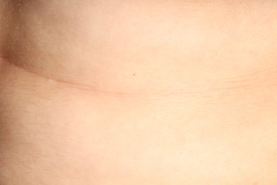 Photo of Human skin, closeup view. Detailed texture of surface