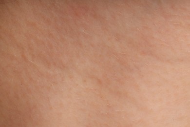 Photo of Human skin, closeup view. Detailed texture of surface