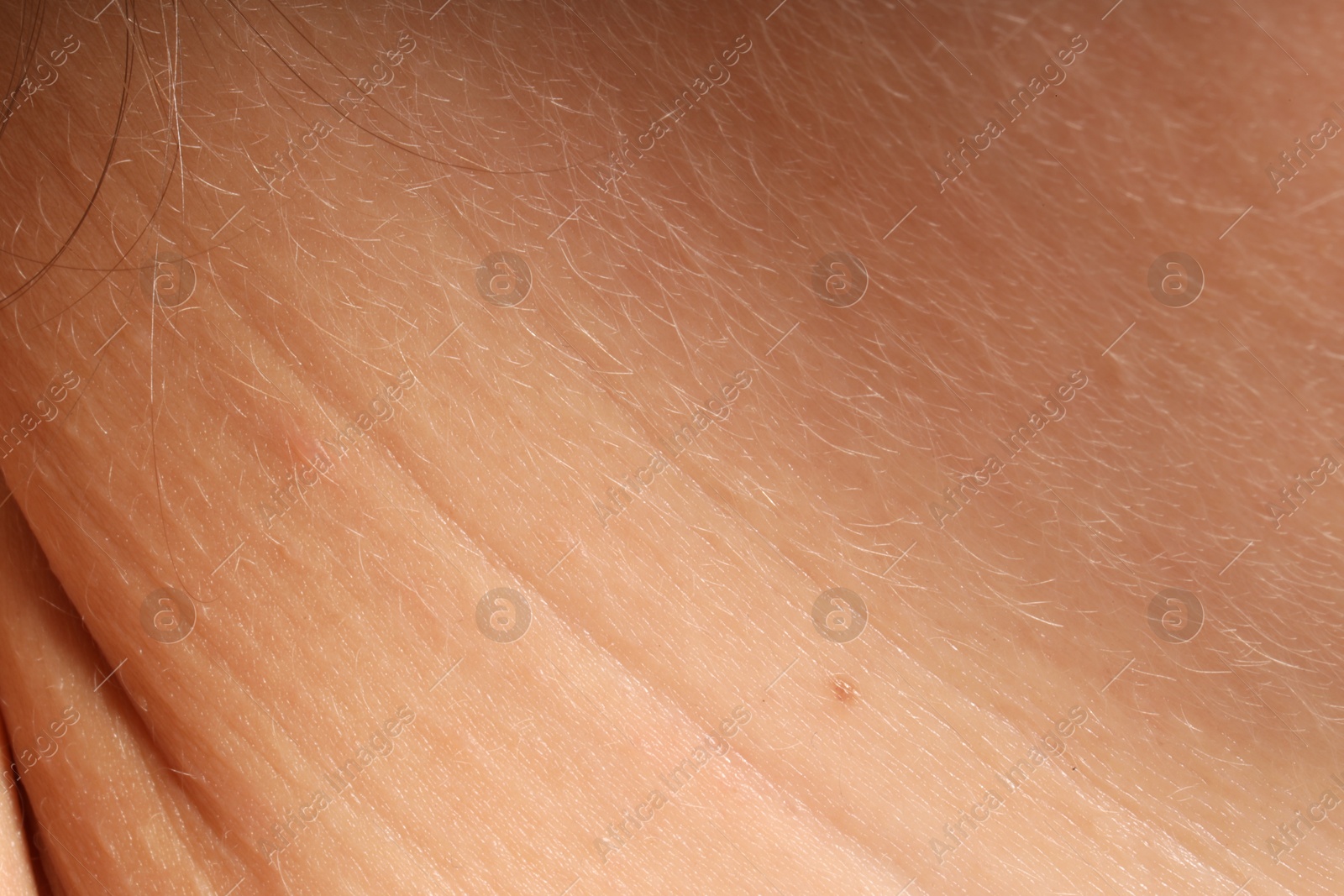 Human skin, closeup view. Detailed texture of surface Photo of Human skin, closeup view. Detailed texture of surface