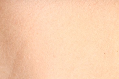 Photo of Human skin, closeup view. Detailed texture of surface