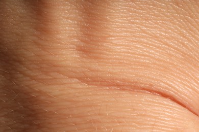 Photo of Human skin, closeup view. Detailed texture of surface