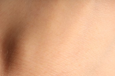 Photo of Human skin, closeup view. Detailed texture of surface