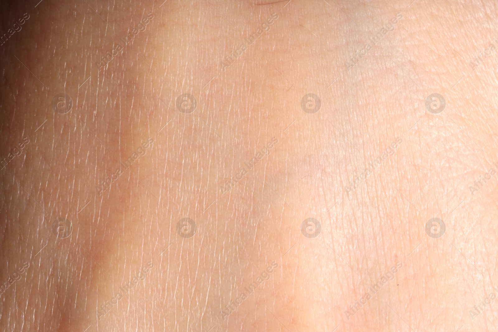 Human skin, closeup view. Detailed texture of surface Photo of Human skin, closeup view. Detailed texture of surface
