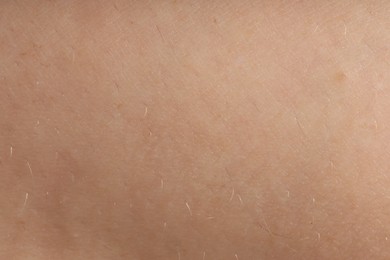 Photo of Human skin, closeup view. Detailed texture of surface