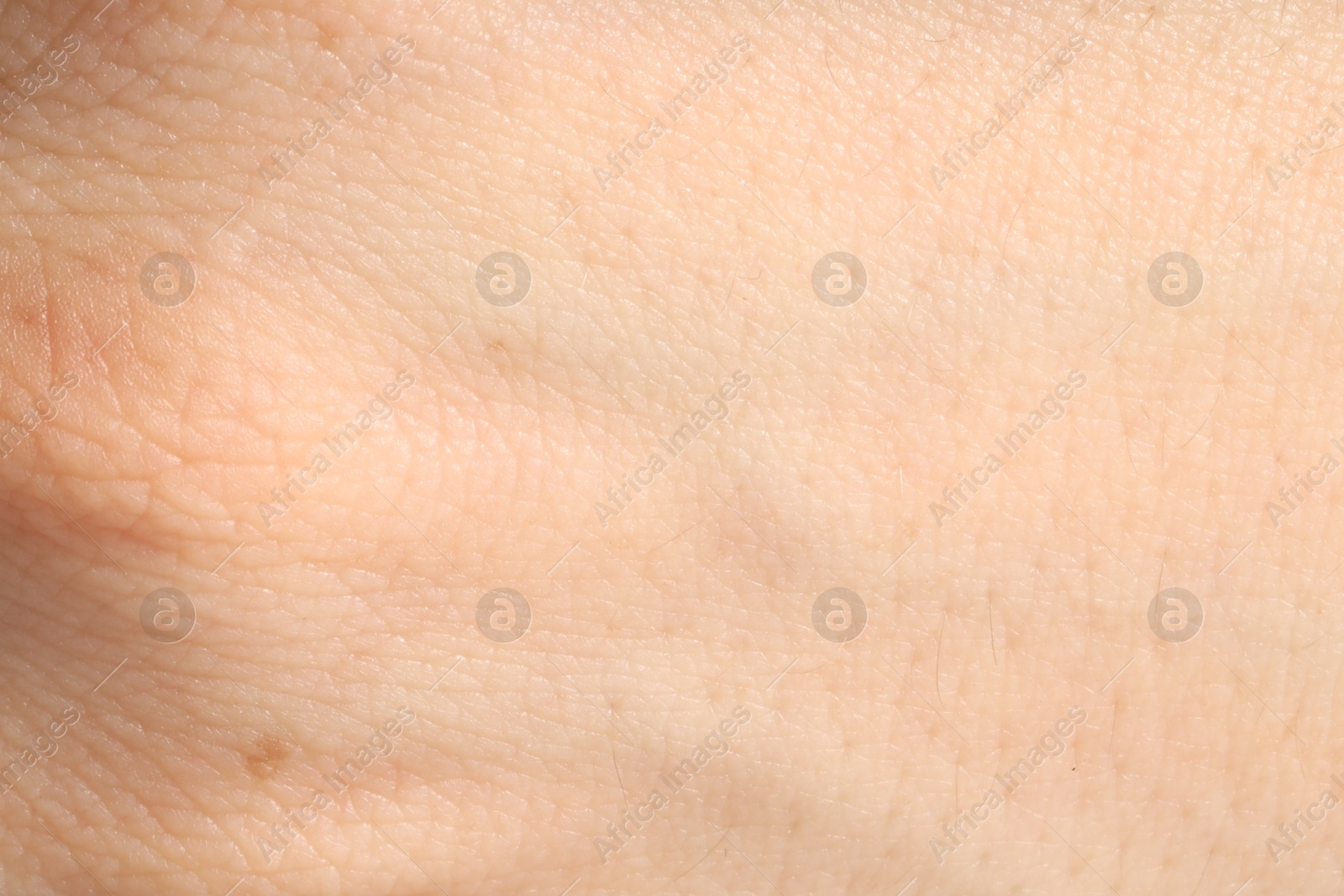 Human skin, closeup view. Detailed texture of surface Photo of Human skin, closeup view. Detailed texture of surface