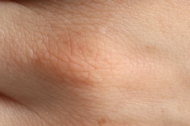 Photo of Human skin, closeup view. Detailed texture of surface