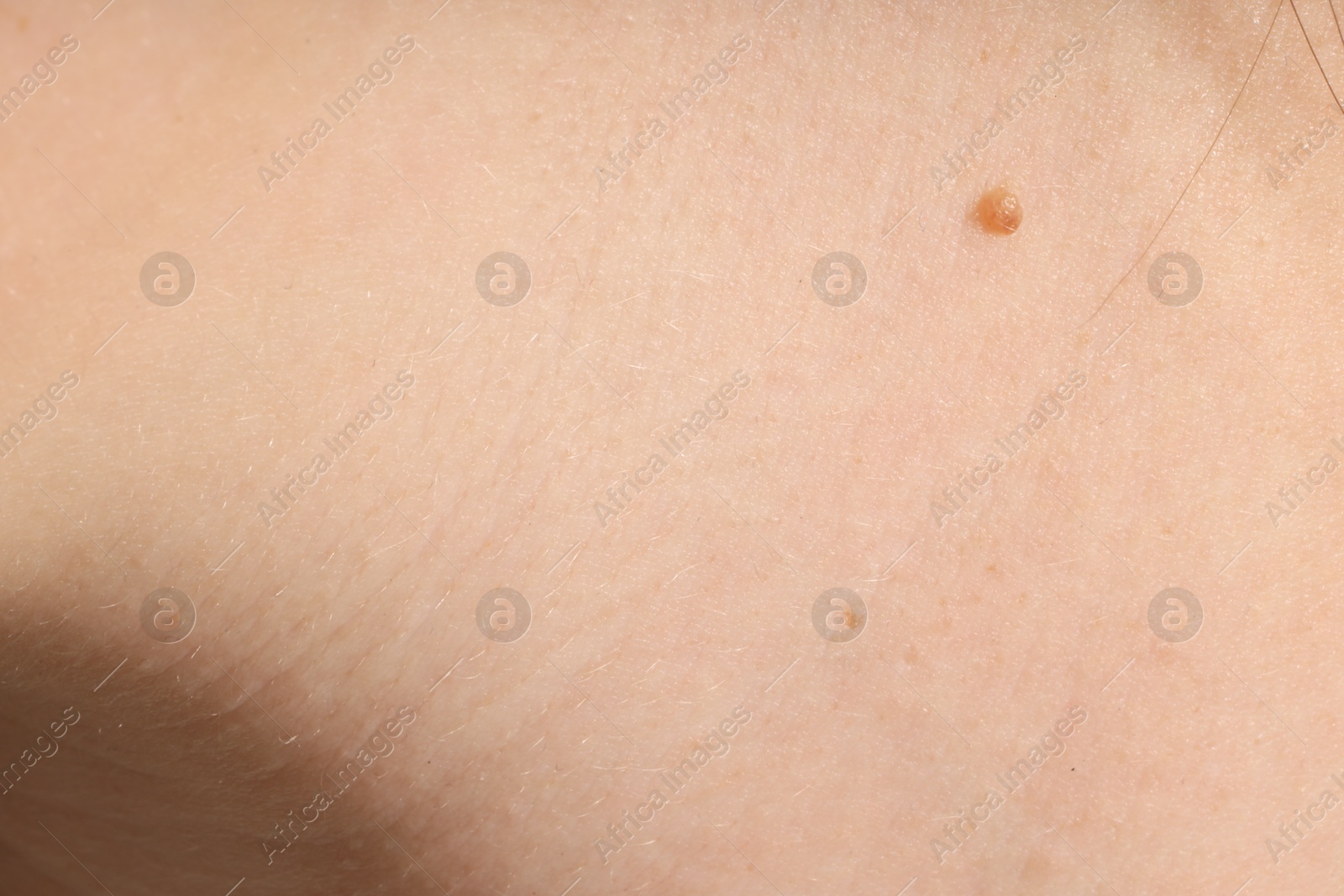Human skin, closeup view. Detailed texture of surface Photo of Human skin, closeup view. Detailed texture of surface