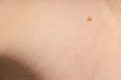Photo of Human skin, closeup view. Detailed texture of surface