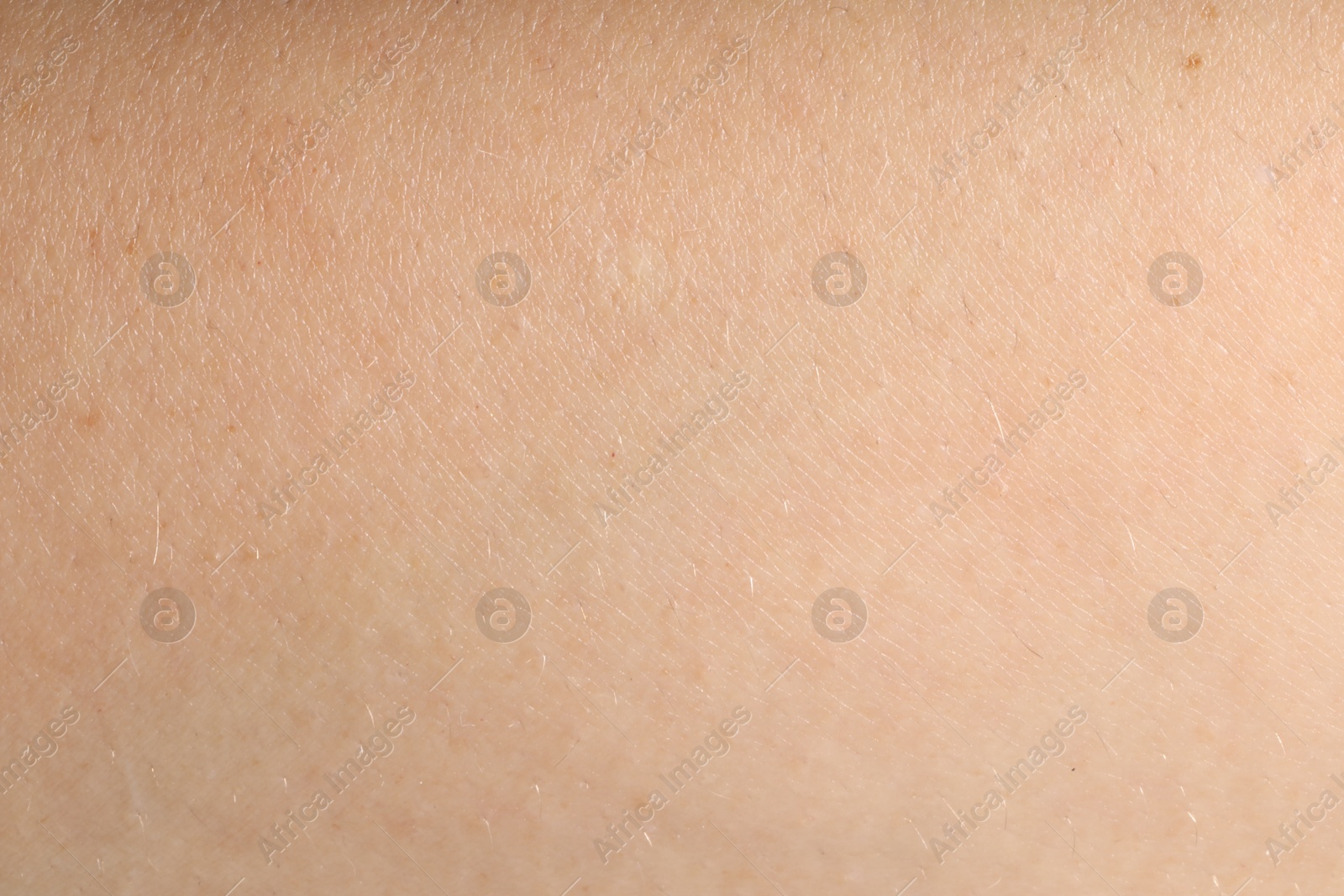 Human skin, closeup view. Detailed texture of surface Photo of Human skin, closeup view. Detailed texture of surface