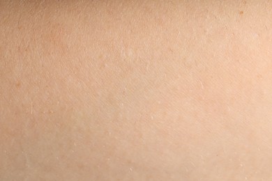 Photo of Human skin, closeup view. Detailed texture of surface