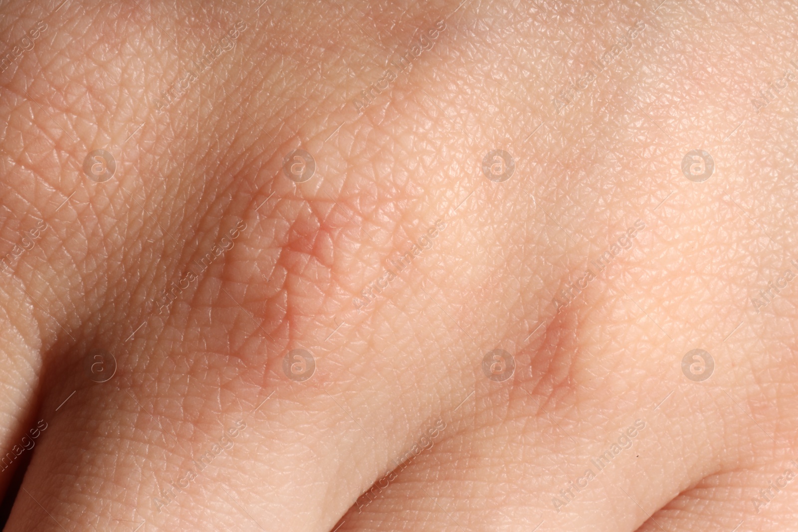Macro view of normal skin as background Photo of Macro view of normal skin as background