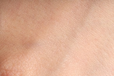 Photo of Macro view of normal skin as background