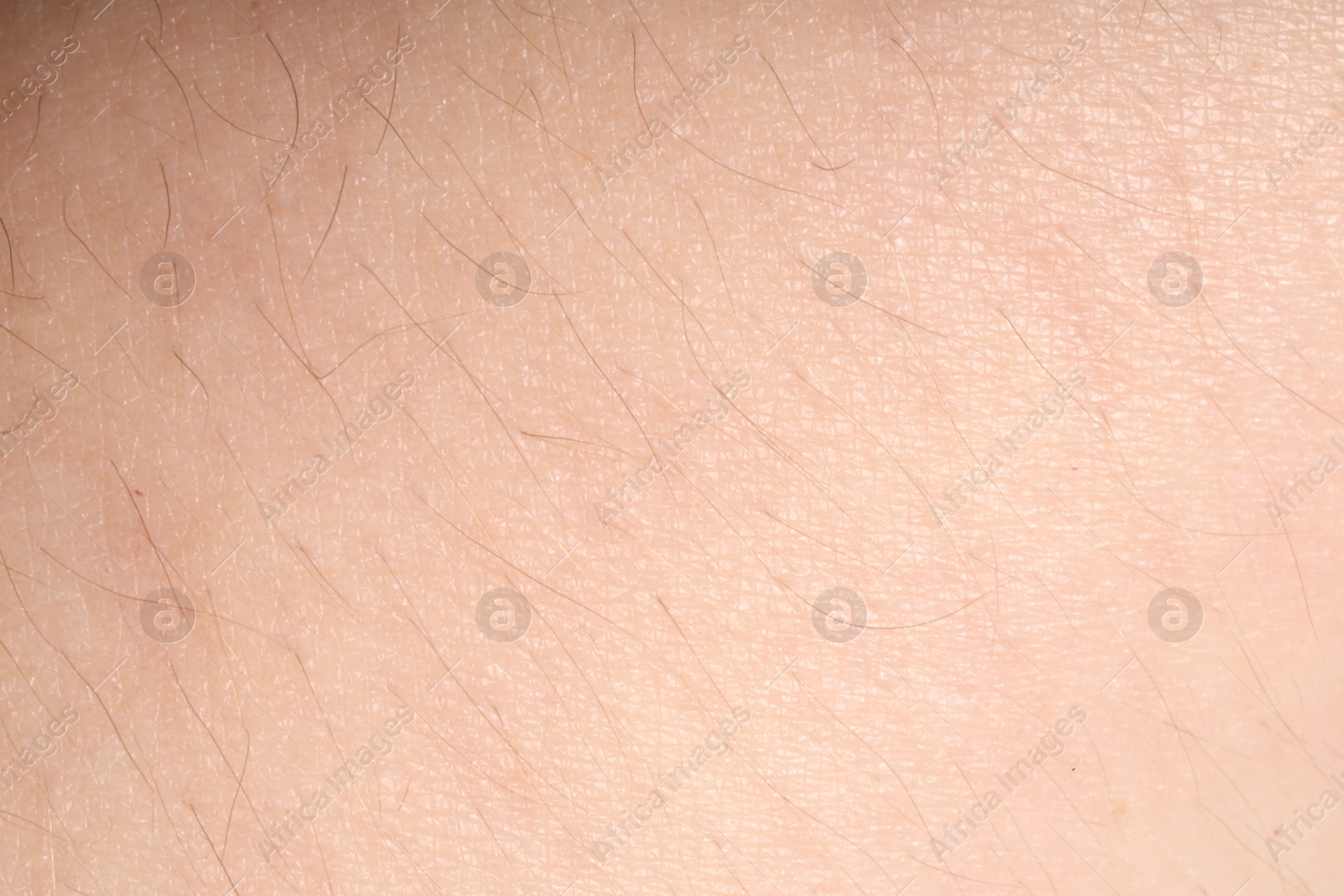 Macro view of normal skin as background Photo of Macro view of normal skin as background