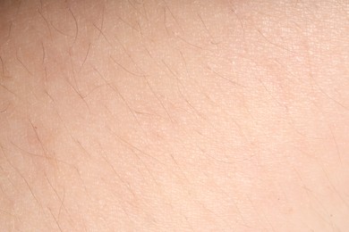 Photo of Macro view of normal skin as background
