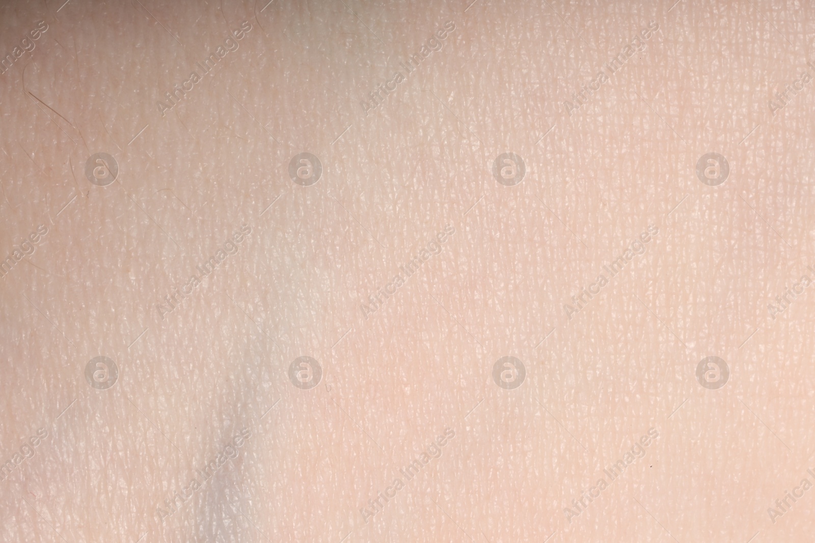 Macro view of normal skin as background Photo of Macro view of normal skin as background