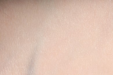Photo of Macro view of normal skin as background
