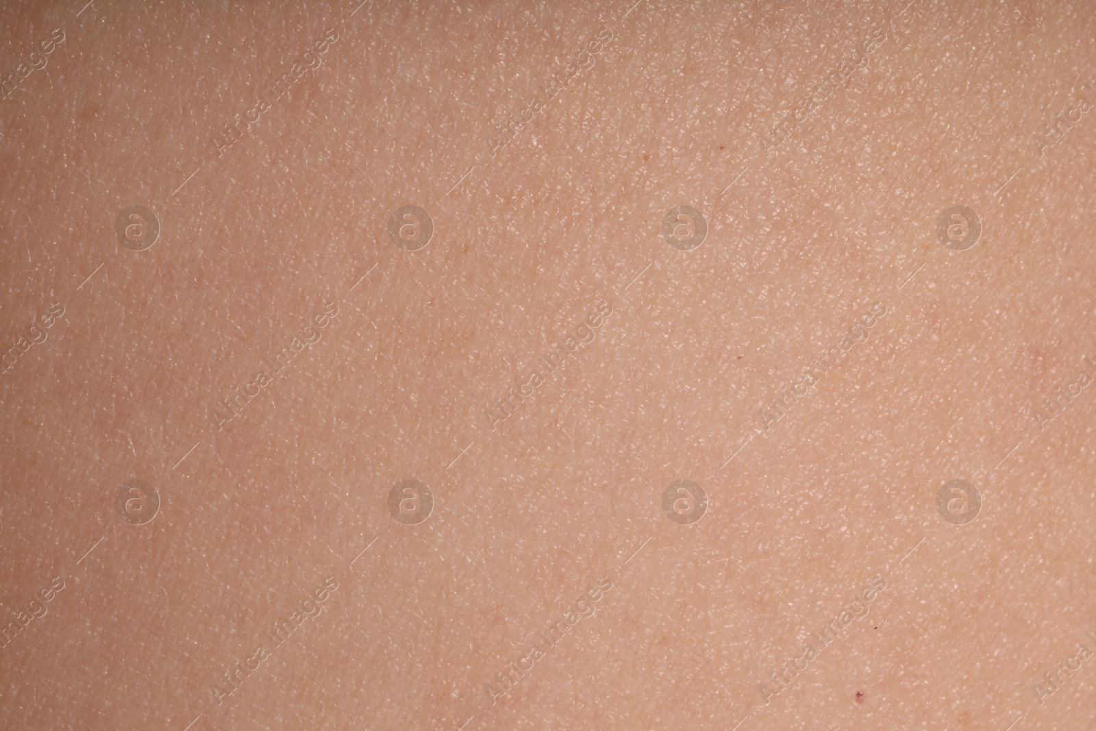 Macro view of normal skin as background Photo of Macro view of normal skin as background