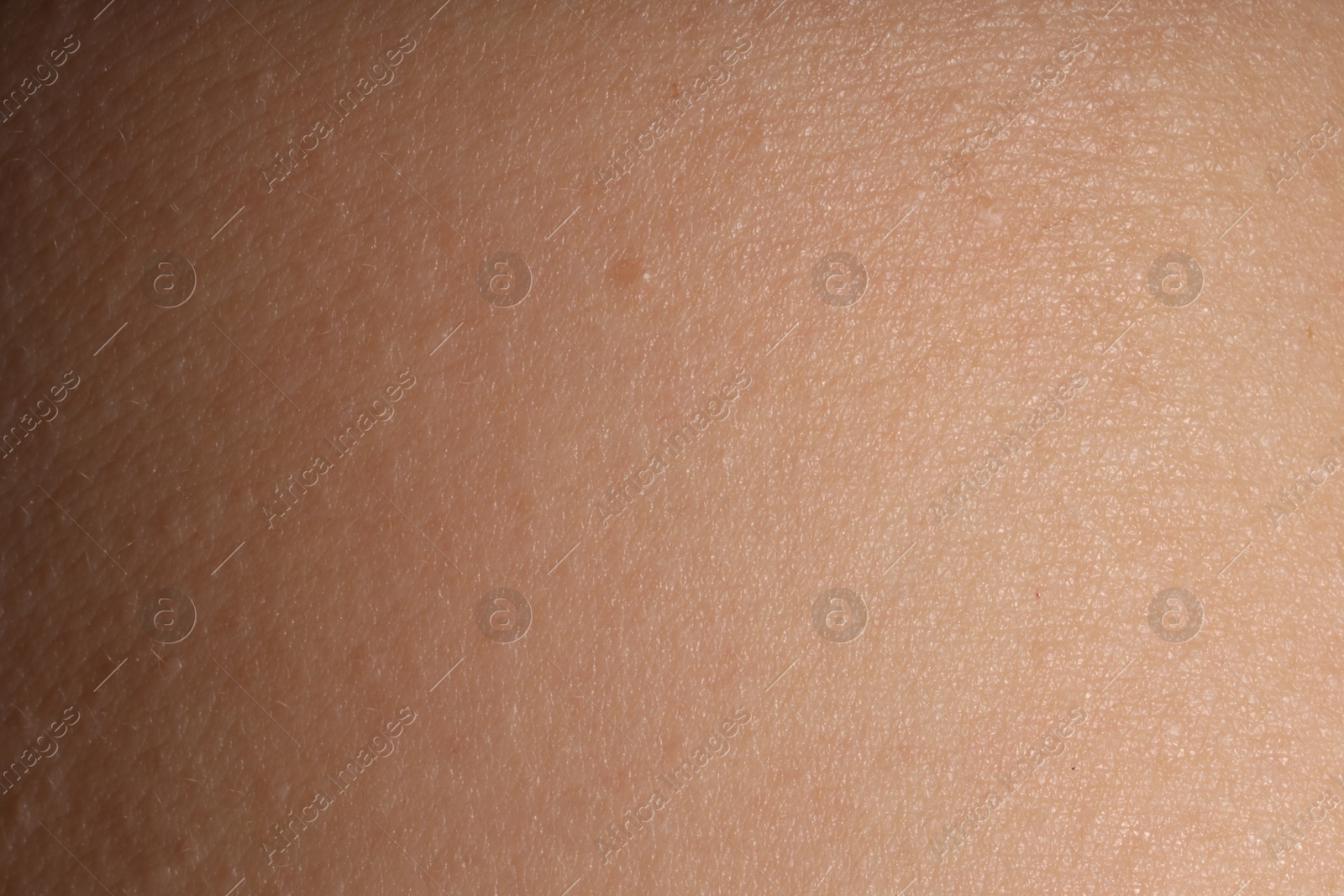 Macro view of normal skin as background Photo of Macro view of normal skin as background
