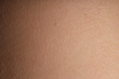 Photo of Macro view of normal skin as background