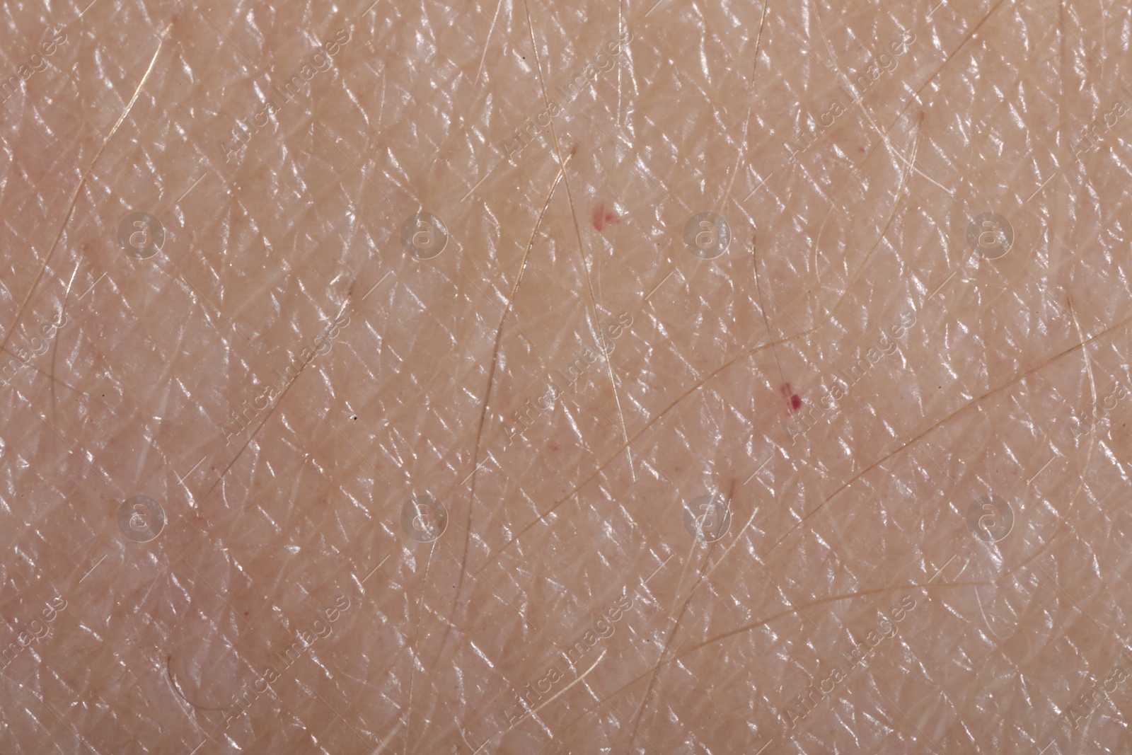 Macro view of human skin as background Photo of Macro view of human skin as background