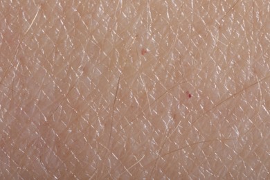 Photo of Macro view of human skin as background