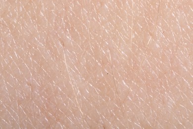 Photo of Macro view of human skin as background
